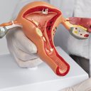 Imagem Santa Casa amplia assistência à saúde da mulher com exames para endometriose