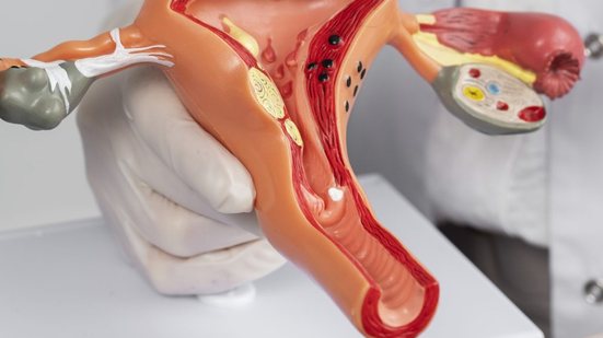 Imagem Santa Casa amplia assistência à saúde da mulher com exames para endometriose