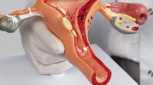 Imagem Santa Casa amplia assistência à saúde da mulher com exames para endometriose