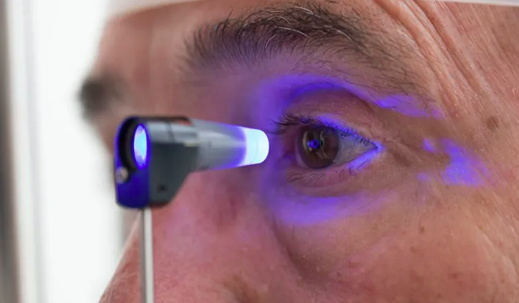 Estudo aponta risco maior de glaucoma entre homens que usam tadalafila por longos períodos