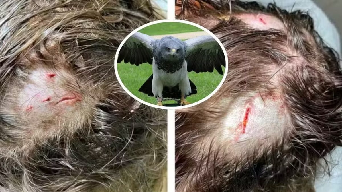 Primeiro ataque de harpia a humano já documentado no mundo ocorre na Amazônia e acende alerta
