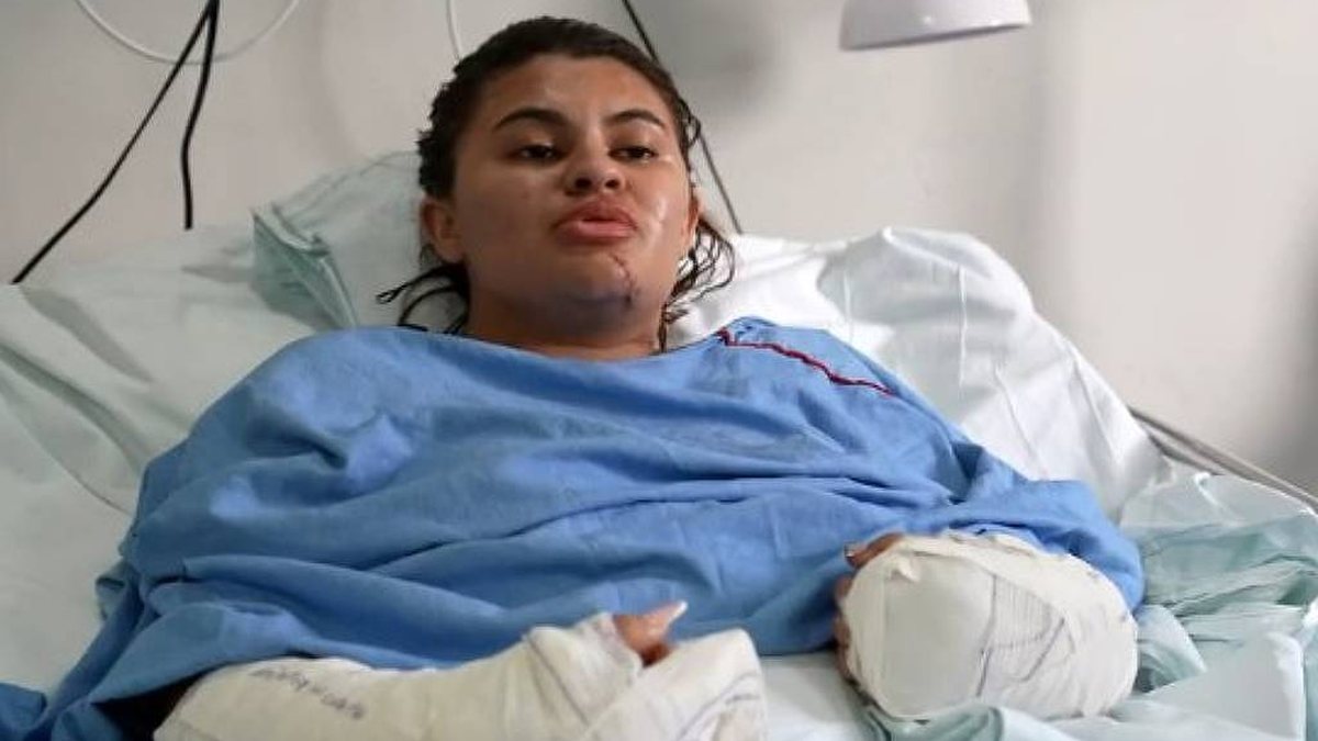 \u0027Me fiz de morta\u0027, diz estudante que teve as mãos amputadas em ataque com foice