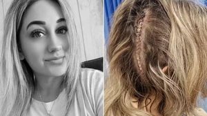Reprodução/Brain Tumour Research