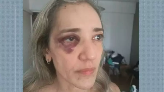 Reprodução/TV Globo