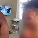Polícia investiga agressão contra doméstica acusada de roubo por ex-patroa - Reprodução / TV Mirante