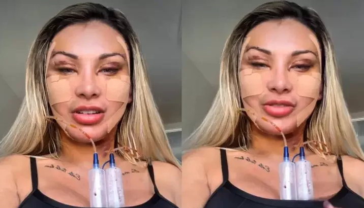 Reprodução