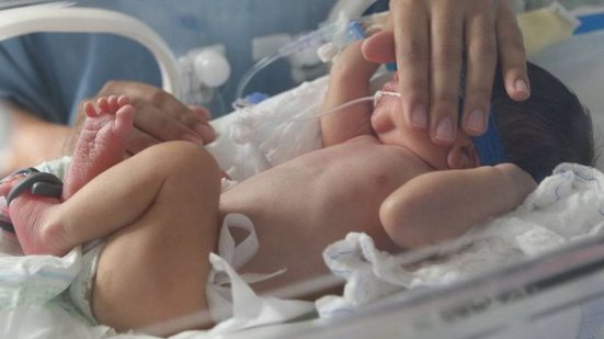 Casos de bronquiolite em bebês caem após chegada de vacina para gestantes no SUS