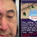 Heriverto Hernandez acordou no meio da noite em Chicago com ratos roendo o seu rosto — Foto Reprodução