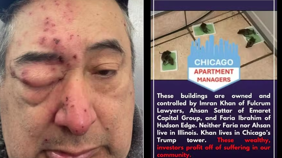 Heriverto Hernandez acordou no meio da noite em Chicago com ratos roendo o seu rosto — Foto Reprodução
