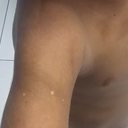Imagens mostram hematomas em menino de 3 anos - Conselho Tutelar