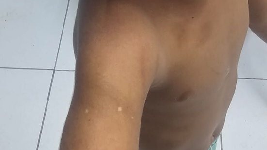 Imagens mostram hematomas em menino de 3 anos - Conselho Tutelar