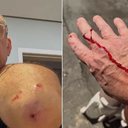 José Burnier, apresentador do SP2, relatou um ataque de pitbull na tarde de domingo - Reprodução / Instagram
