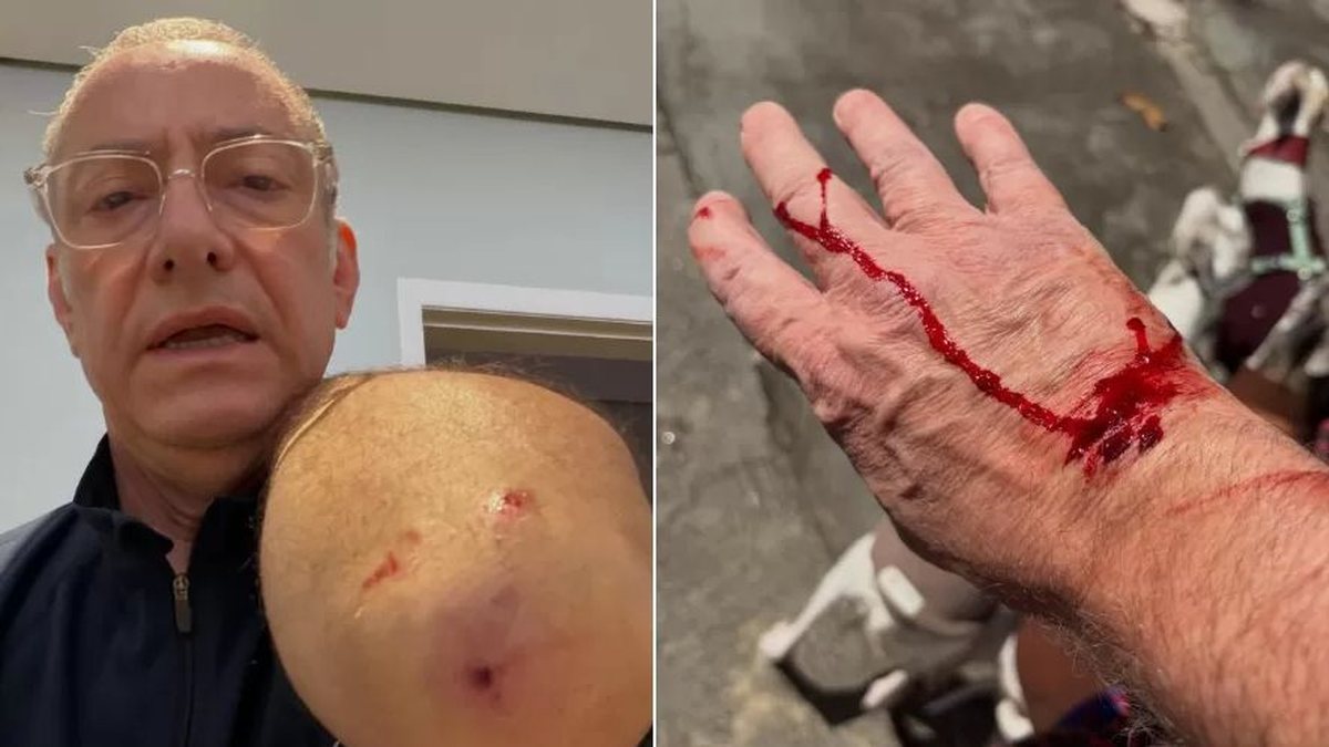Jornalista da Globo é atacado por pitbull sem guia