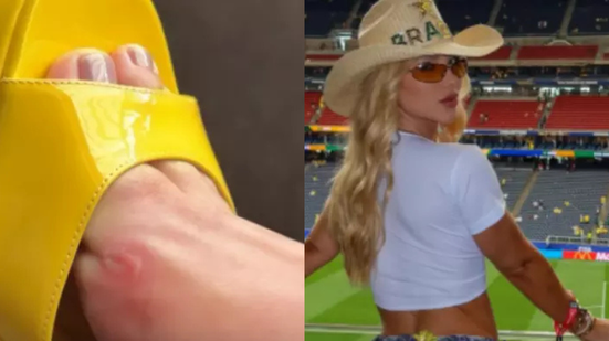 Reprodução