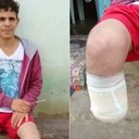 Reprodução