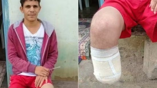 Reprodução