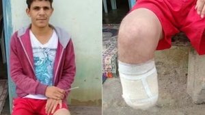 Reprodução