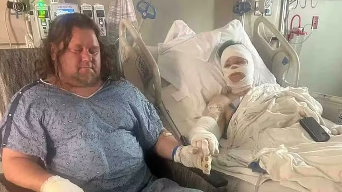 Homem salva a esposa após explosão em food truck e casal celebra 25 anos de casados em hospital