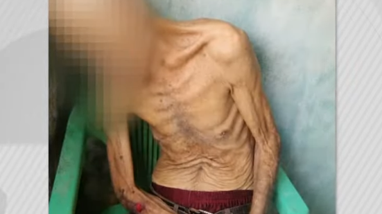 Idoso estava debilitado e era mantido em condições precárias - Foto: Reprodução