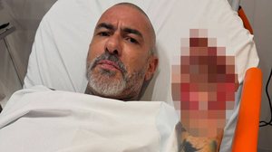 Henrique Fogaça revela detalhes acidente de moto e denuncia furto de aliança: 'Quase morri' - Reprodução / Redes sociais