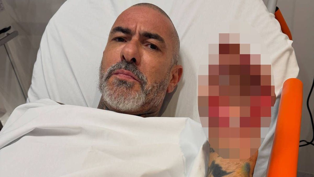 Henrique Fogaça revela detalhes acidente de moto e denuncia furto de aliança: \u0027Quase morri\u0027