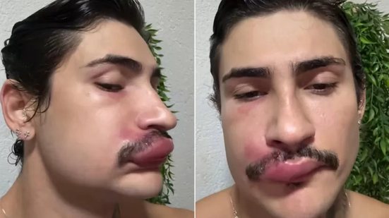Foto: Reprodução/Redes Sociais