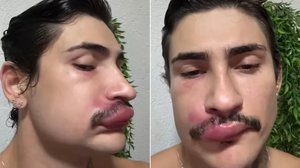 Foto: Reprodução/Redes Sociais