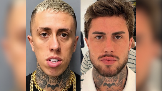 Reprodução/Instagram Dr. Igor Alves