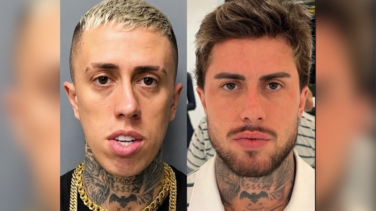 Responsável pela harmonização de MC Daniel detalha procedimentos e entrega pedido do funkeiro