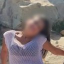 Mulher teve corpo queimado após companheiro tentar matá-la no Tabuleiro do Martins - Foto: Reprodução