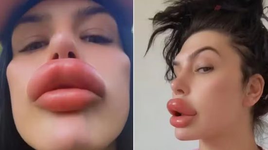 Reprodução/Instagram