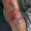 Imagem Idoso de 82 anos sofre capacetadas em assalto e tem R$ 10 mil roubados no Sertão; mulher é presa