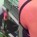 Imagem Mulher denuncia assédio após ser mordida e agarrada por instrutor de academia