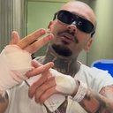 Streamer Adalton Rodrigues, de 31 anos, teve o dedo amputado após tentar pular uma grade do Rock in Rio - Reprodução