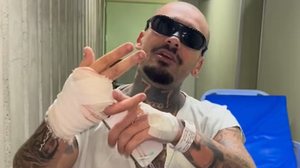 Streamer Adalton Rodrigues, de 31 anos, teve o dedo amputado após tentar pular uma grade do Rock in Rio - Reprodução