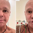 O cantor foi diagnosticado com o câncer no sistema linfático em março de 2025 - Foto: Reprodução