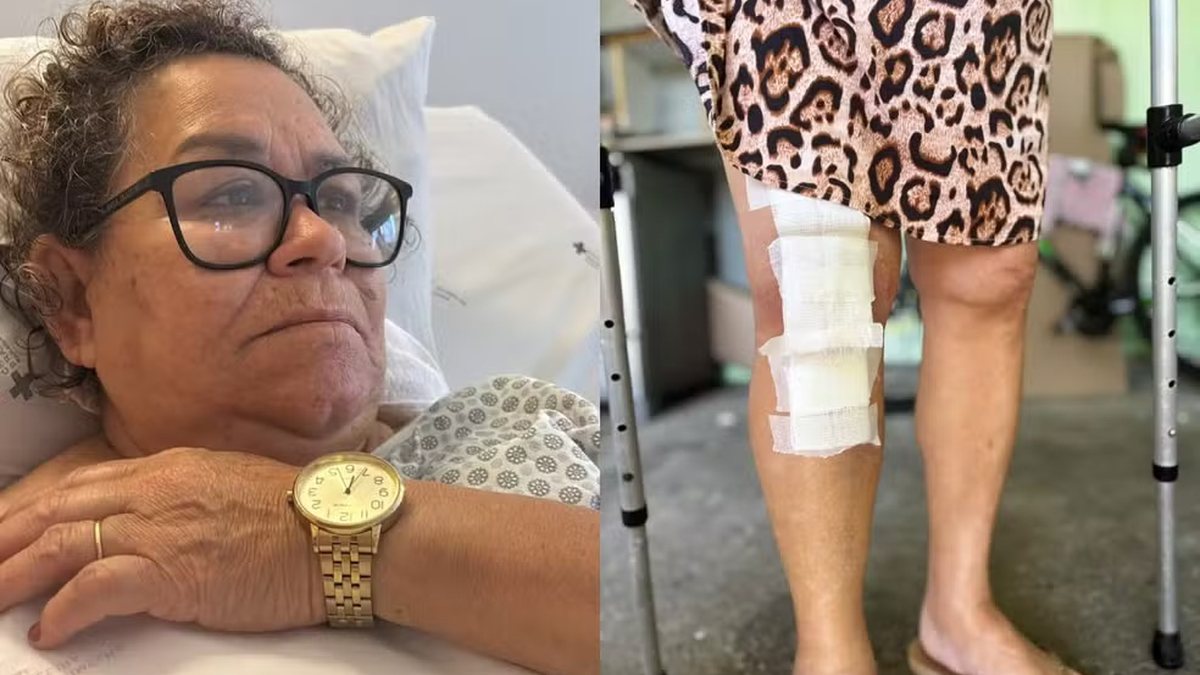 Idosa tem prótese implantada no joelho errado durante cirurgia em hospital particular