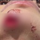 Influenciadora denuncia ex-companheiro por agressão, roubo e afirma que foi arrastada em carro por 100 metros, em Maceió - Reprodução / Instagram