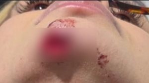 Influenciadora denuncia ex-companheiro por agressão, roubo e afirma que foi arrastada em carro por 100 metros, em Maceió - Reprodução / Instagram