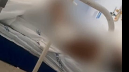 Imagem Mulher dá entrada em hospital com sangramento e irmã denuncia estupro em Santana do Ipanema