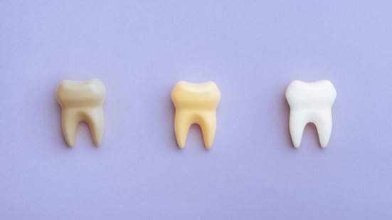 A alimentação e os hábitos diários estão entre os principais fatores que influenciam a cor dos dentes (Imagem: Nicoleta Ionescu | Shutterstock)