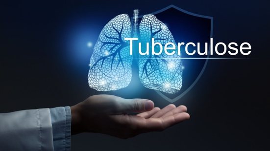 A tuberculose é uma doença infecciosa que afeta principalmente os pulmões (Imagem: mi_viri | Shutterstock)