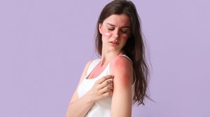 Cuidados simples ajudam a recuperar a pele após a queimadura de sol (Imagem: Pixel-Shot | Shutterstock)