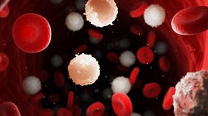 A leucemia é um câncer comum (Imagem: 3dMediSphere | Shutterstock)