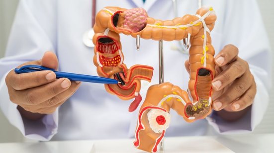 Rastreamento precoce e hábitos saudáveis aumentam a chance de cura e reduzem mortes por câncer colorretal (Imagem: sasirin pamai | Shutterstock)