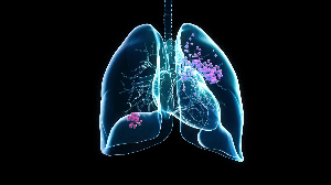 Ampliar a prevenção e a identificação precoce do câncer de pulmão é fundamental para reduzir a taxa de mortalidade (Imagem: Julien Tromeur | Shutterstock)