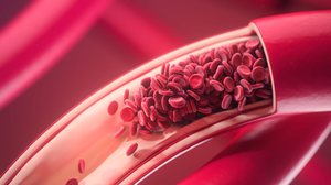 A combinação de calor e imobilidade prolongada eleva o risco de trombose (Imagem: KateStudio | Shutterstock)