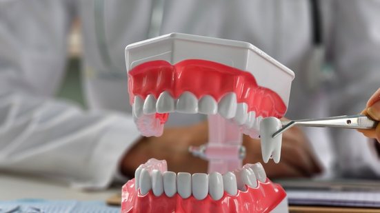 Presente em grande parte da população, o siso pode não encontrar espaço suficiente na arcada dentária e gerar complicações (Imagem: NMK-Studio | Shutterstock)