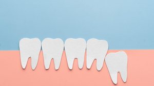 Nem sempre há espaço suficiente na boca para que os dentes do siso nasçam corretamente (Imagem: Orawan Pattarawimonchai | Shutterstock)