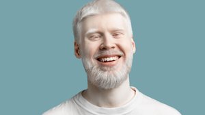 Dia Internacional de Conscientização sobre o Albinismo busca combater estigmas sociais sobre a condição (Imagem: Prostock-studio | Shutterstock)